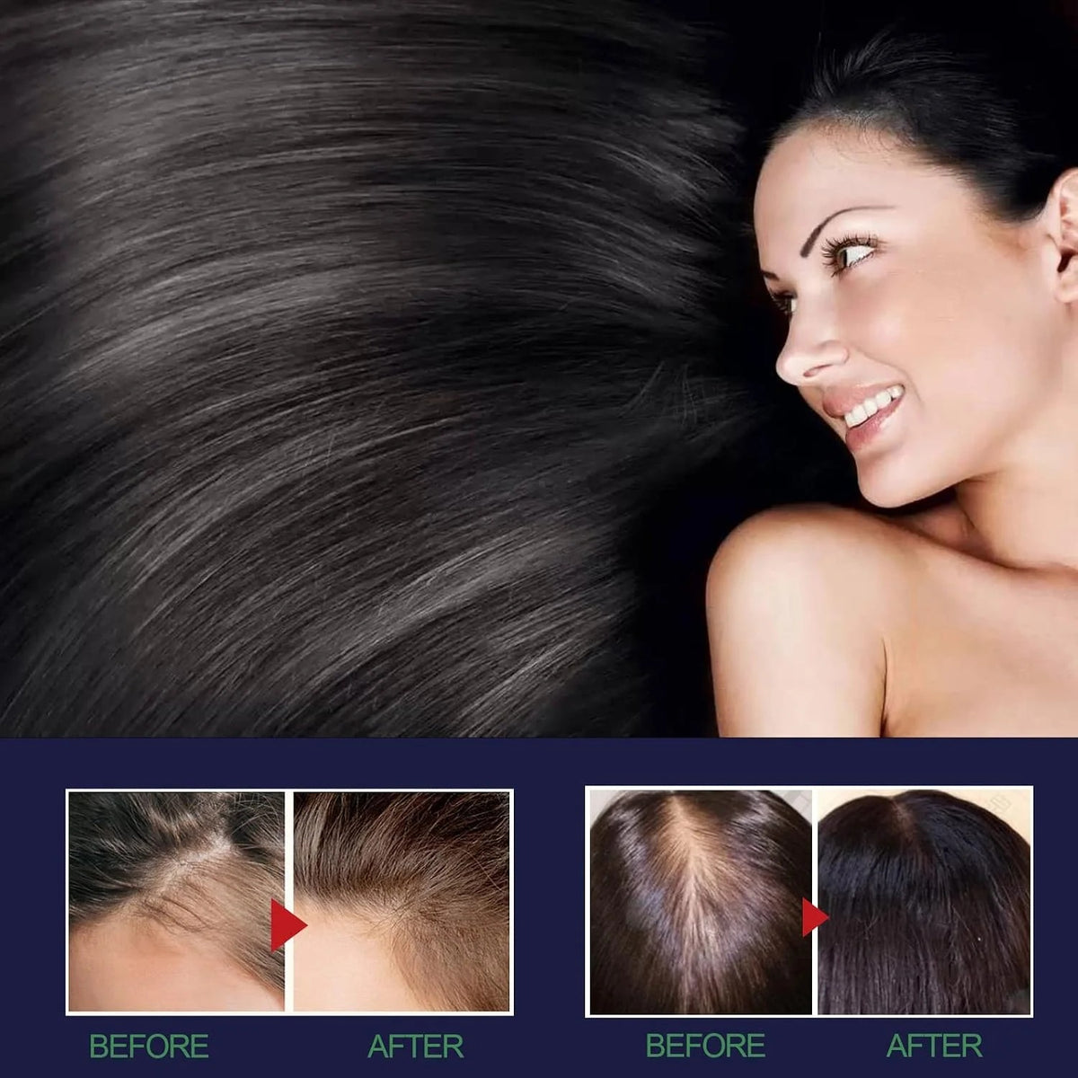 OUHOE Hair Growth Spray