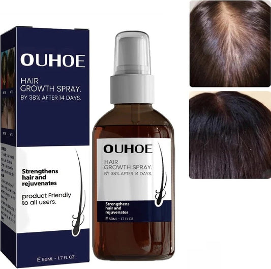 OUHOE Hair Growth Spray