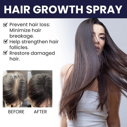 OUHOE Hair Growth Spray